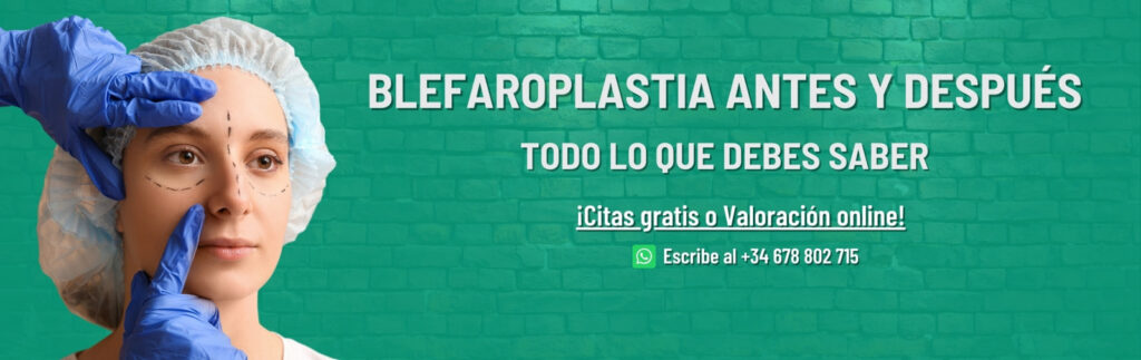 blefaroplastia antes y después