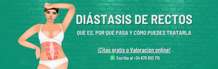 Diástasis abdominal de rectos