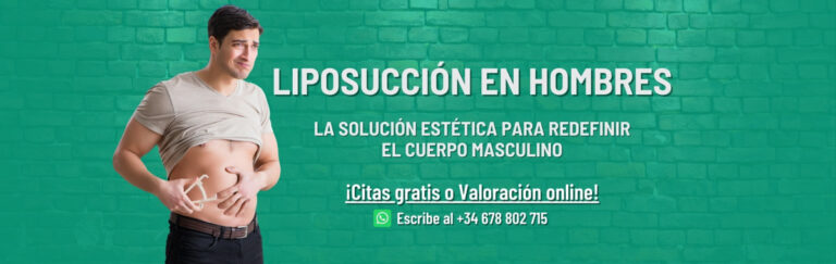 Liposucción en hombres en Madrid