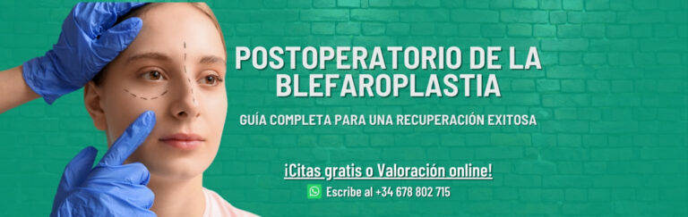 Postoperatorio de la blefaroplastia: guía completa para una recuperación exitosa