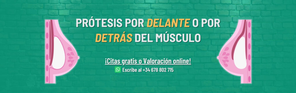 aumento de pecho delante o detrás del músculo planos