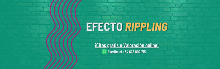 efecto rippling en implantes de mama